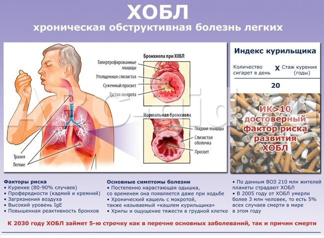 Хроническая обструктивная болезнь легких