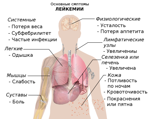 Основные симптомы рака крови